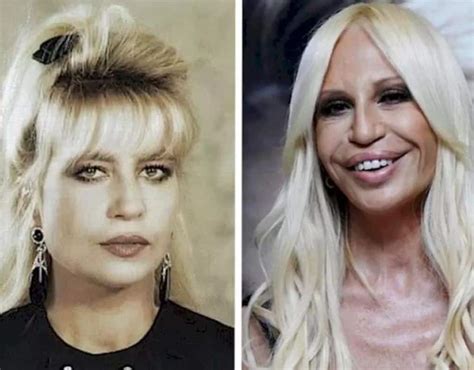 versace donna nera|what happened to donatella versace's face.